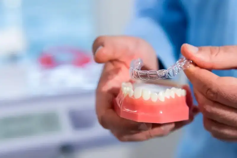 Ile kosztują nakładki Invisalign?