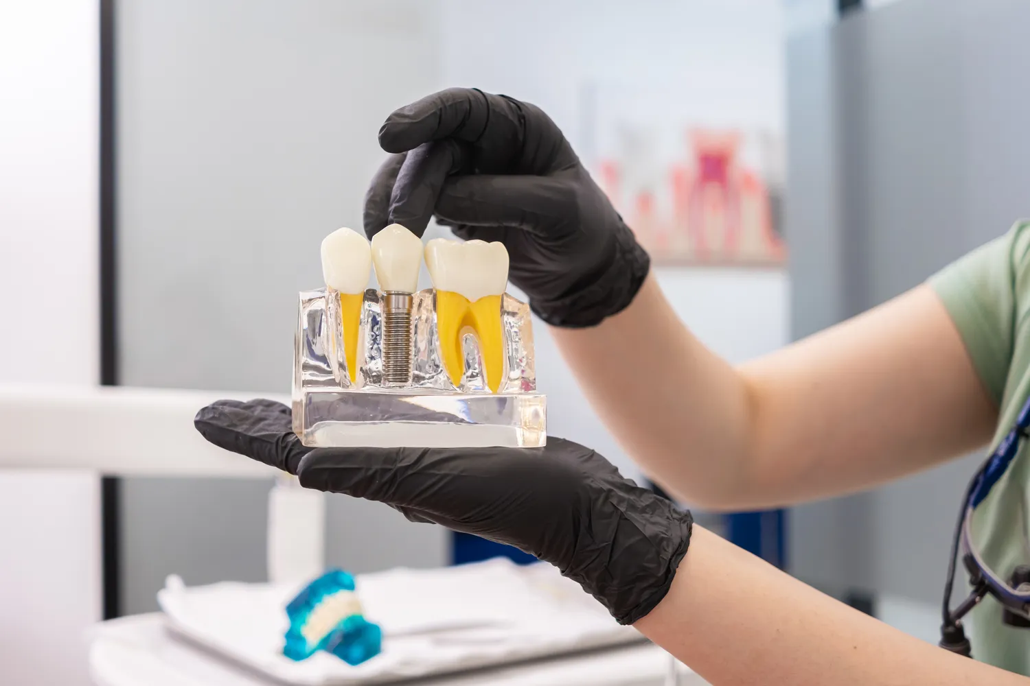 Klinika implantologii Lublin