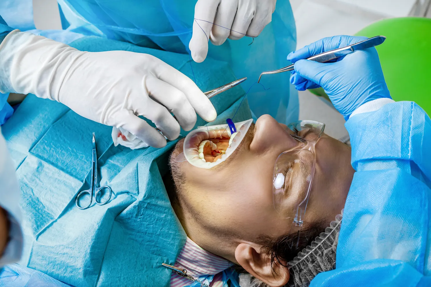 E recepta antykoncepcja ile wazna?